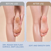 Electric Foot File – Rechargeable Callus Remover | AuriGlam